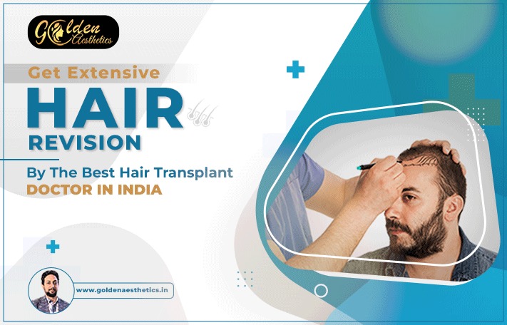 Get Extensive Hair Revision by the Best Hair Transplant Doctor in India