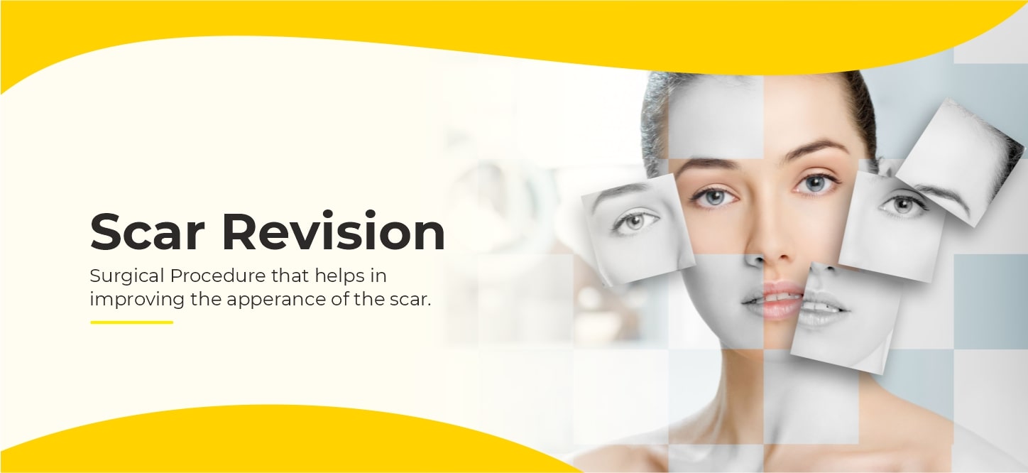 Scar Revision in India