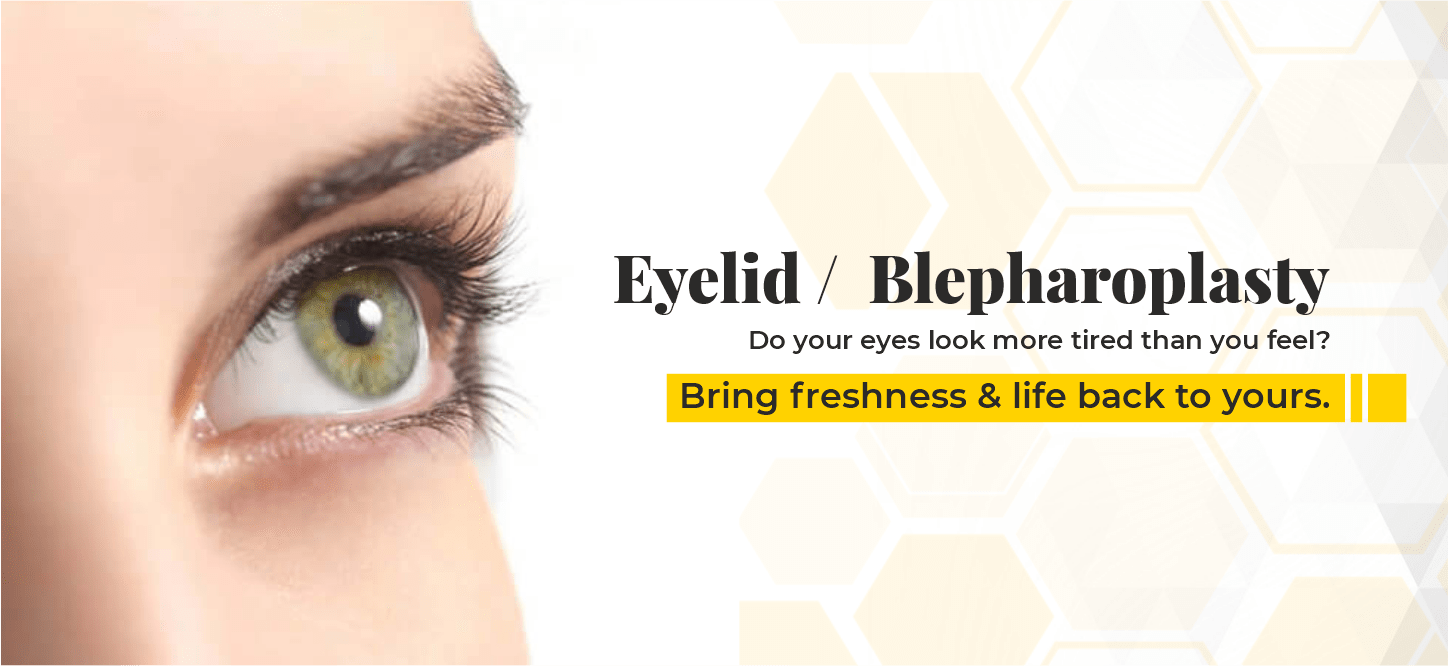 Eyelid Surgery in India